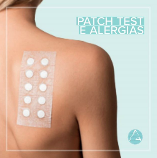 Patch test e Alergias
